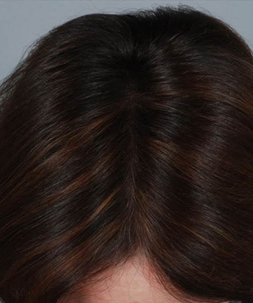 A woman showing her hair after lasercap treatment