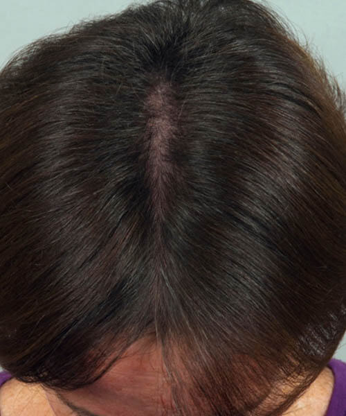 A woman showing her black hair before treatment