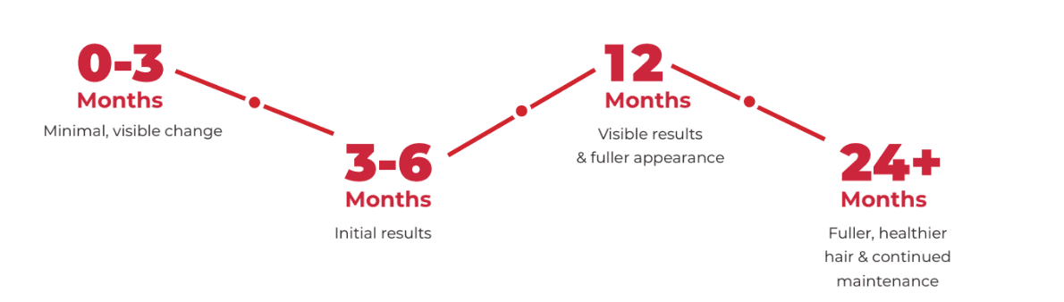 Timeline of Results using LaserCap HD+