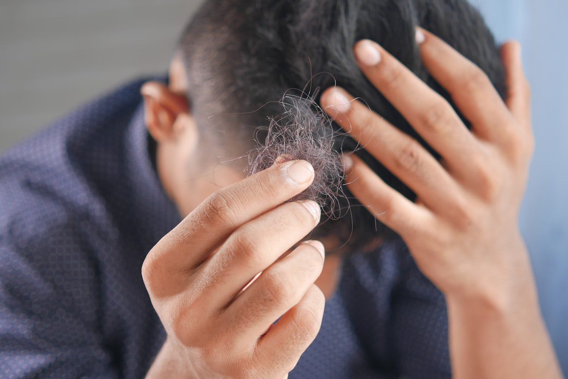 A man holding strands of his hair