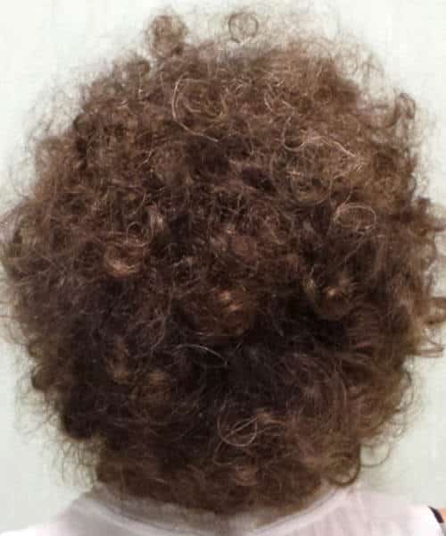 A child with curly hair after lasercap treatment