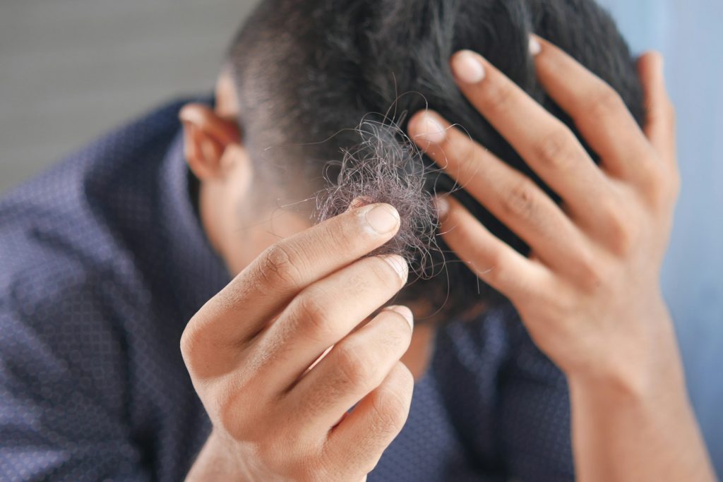 A balding man holding his hair