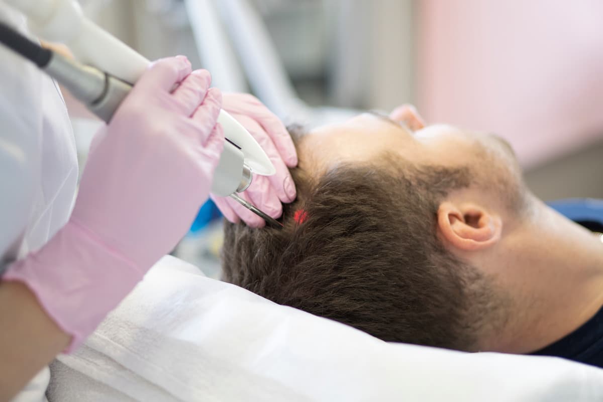 A Man Receiving Laser Treatment For Hair Loss