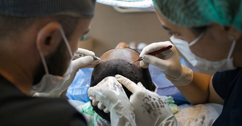 Surgeons performing hair transplant surgery